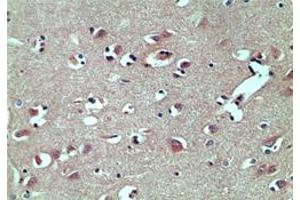 Image no. 1 for anti-TAR (HIV-1) RNA Binding Protein 2 (TARBP2) (AA 340-390) antibody (ABIN207742)