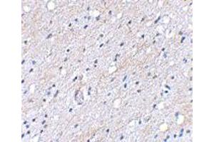 Immunohistochemical staining of human brain tissue using BAIAP3 polyclonal antibody  at 5 ug/mL . (BAIAP3 anticorps  (N-Term))