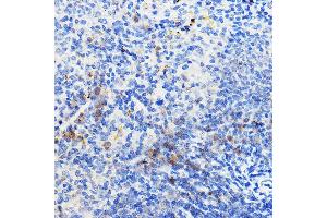 Immunohistochemistry of paraffin-embedded mouse spleen using IL24 Rabbit pAb (ABIN6128082, ABIN6142368, ABIN6142369 and ABIN6219012) at dilution of 1:100 (40x lens). (IL-24 anticorps  (AA 52-140))