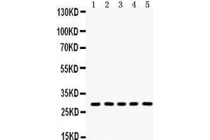 Anti- Aquaporin 1 Picoband antibody, Western blotting All lanes: Anti Aquaporin 1  at 0. (Aquaporin 1 anticorps  (C-Term))