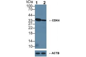 Western blot analysis of (1) Wild-type HeLa cell lysate, and (2) CDK4 knockout HeLa cell lysate, using Rabbit Anti-Human CDK4 Antibody (1 µg/ml) and HRP-conjugated Goat Anti-Mouse antibody (abx400001, 0. (CDK4 anticorps  (AA 6-295))