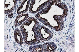 Image no. 3 for anti-Deoxythymidylate Kinase (Thymidylate Kinase) (DTYMK) antibody (ABIN1497918) (DTYMK anticorps)