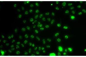 Immunofluorescence analysis of A549 cells using ETV1 Polyclonal Antibody (ETV1 anticorps)