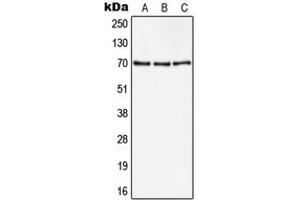 Western blot analysis of CD105 expression in Hela (A), A549 (B), NIH3T3 (C) whole cell lysates. (Endoglin anticorps  (Center))