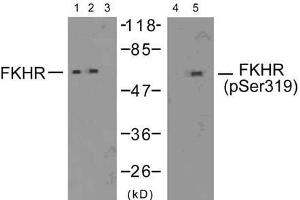 Western blot analysis of extracts from 293 cells (10% serum-treated, 15min) and HeLa cells (EGF-treated, 200ng/ml, 15min), using FKHR (Ab-319) antibody (E021161, Lane 1, 2 and 3) and FKHR (phospho-Ser319) antibody (E011136, Lane 4 and 5). (FOXO1 anticorps  (pSer319))