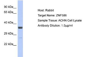 Host: Rabbit Target Name: ZNF586 Sample Type: ACHN Whole cell lysates Antibody Dilution: 1. (ZNF586 anticorps  (Middle Region))