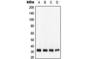 Western blot analysis of NQO1 expression in HepG2 (A), SW480 (B), HCT 116 (C), K562 (D) whole cell lysates.