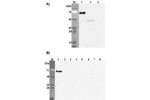 Western blot analysis of human Pref-1using anti-DLK1 (human), mAb (PF13-3)  at 1: 2,000 dilution. (DLK1 anticorps  (Extracellular Domain))