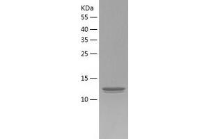 Western Blotting (WB) image for Prefoldin Subunit 5 (PFDN5) (AA 1-154) protein (His tag) (ABIN7124550)