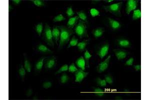 Immunofluorescence of monoclonal antibody to EHD2 on HeLa cell. (EHD2 anticorps  (AA 365-427))