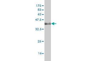 Western Blot detection against Immunogen (38. (DLX2 anticorps  (AA 1-110))