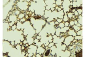 ABIN6277517 at 1/100 staining Mouse lung tissue by IHC-P.