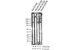 Western blot analysis of Phospho-FAK (Tyr925) expression in various lysates