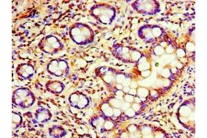 Immunohistochemistry of paraffin-embedded human small intestine tissue using ABIN7174852 at dilution of 1:100 (C4ORF3 anticorps  (AA 1-44))