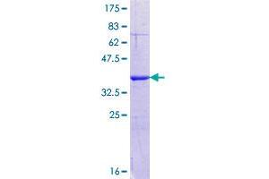 Image no. 1 for MLX Interacting Protein-Like (MLXIPL) (AA 603-700) protein (GST tag) (ABIN1311033)