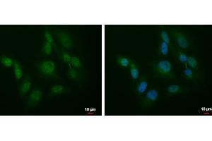 ICC/IF Image SLU7 antibody detects SLU7 protein at cytoplasm and nucleus by immunofluorescent analysis. (SLU7 anticorps  (C-Term))
