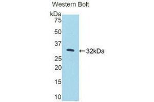 Western Blotting (WB) image for anti-Protein Kinase N2 (PKN2) (AA 67-312) antibody (ABIN1175309) (PKN2 anticorps  (AA 67-312))