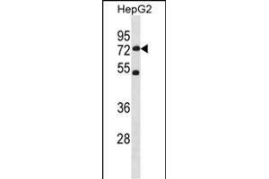 SETD3 Antibody (C-term) (ABIN1881794 and ABIN2838755) western blot analysis in HepG2 cell line lysates (35 μg/lane). (SETD3 anticorps  (C-Term))