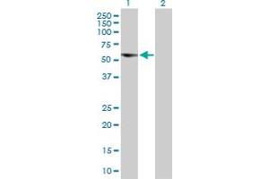 Western Blot analysis of C17orf57 expression in transfected 293T cell line by C17orf57 MaxPab polyclonal antibody. (C17orf57 anticorps  (AA 1-531))