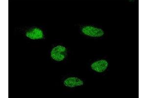 Immunofluorescence of monoclonal antibody to C11orf30 on HeLa cell. (EMSY anticorps  (AA 1081-1178))