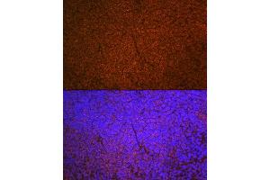 Immunofluorescence analysis of mouse spleen using SHIP11 Rabbit mAb (ABIN7267882) at dilution of 1:100 (40x lens). (INPP5D anticorps)