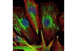 Immunofluorescence analysis of U251 cells using KLHL22 mouse mAb (green).