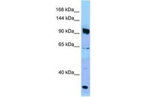 Image no. 1 for anti-PARG (PARG) (AA 770-819) antibody (ABIN6748252) (PARG anticorps  (AA 770-819))