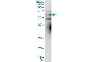 KCNA3 monoclonal antibody (M01), clone 1D8 Western Blot analysis of KCNA3 expression in Hela S3 NE .