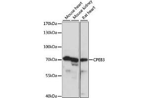 Western blot analysis of extracts of various cell lines, using CPEB3 antibody (ABIN7266666) at 1:1000 dilution. (CPEB3 anticorps  (AA 150-400))