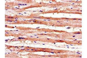 Immunohistochemistry of paraffin-embedded human heart tissue using ABIN7168345 at dilution of 1:100