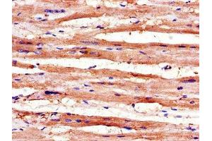 Immunohistochemistry of paraffin-embedded human heart tissue using ABIN7168345 at dilution of 1:100 (RBM4 anticorps  (AA 121-205))