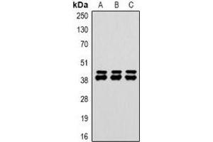 Western blot analysis of DUSP6 expression in HepG2 (A), NIH3T3 (B), rat heart (C) whole cell lysates. (DUSP6 anticorps)