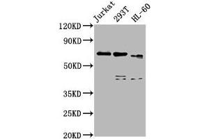 Western Blot Positive WB detected in: Jurkat whole cell lysate, 293T whole cell lysate, HL60 whole cell lysate All lanes: CBFA2T3 antibody at 5 μg/mL Secondary Goat polyclonal to rabbit IgG at 1/50000 dilution Predicted band size: 72, 63, 64, 8 kDa Observed band size: 72 kDa (CBFA2T3 anticorps  (AA 39-159))