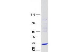 Validation with Western Blot