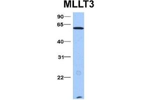 Host:  Rabbit  Target Name:  MLLT3  Sample Type:  Hela  Antibody Dilution:  1. (AF9 anticorps  (N-Term))