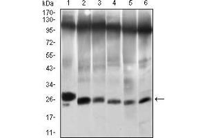 Western blot analysis using TWIST1 mouse mAb against NIH/3T3 (1), JURKAT (2), HELA (3), A549 (4), RAJI (5) and OCM-1 (6) cell lysate. (TWIST1 anticorps  (AA 9-74))