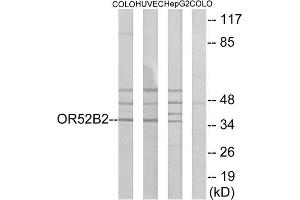 Western blot analysis of extracts from COLO cells, HUVEC cells and HepG2 cells, using OR52B2 antibody. (OR52B2 anticorps  (Internal Region))