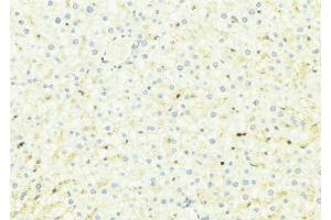 ABIN6275010 at 1/100 staining Mouse liver tissue by IHC-P. (CHSY1 anticorps  (Internal Region))