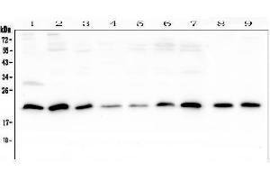 Western blot analysis of SR1 using anti-SR1 antibody (ABIN6719388).