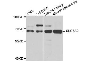 Western blot analysis of extracts of various cell lines, using SLC6A2 antibody (ABIN5974706) at 1/1000 dilution. (SLC6A2 anticorps)