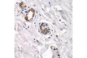 Immunohistochemistry of paraffin-embedded human normal breast using CAPN3 antibody at dilution of 1:200 (400x lens). (Calpain 3 anticorps)