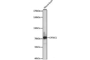 Western blot analysis of extracts of Mouse brain using CRTAC1 Polyclonal Antibody at dilution of 1:1000. (CRTAC1 anticorps)