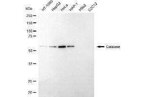 Western blotting analysis using catalase antibody (ABIN7797920). (Recombinant Catalase anticorps)