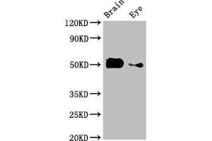 Western Blot Positive WB detected in: Zebrafish brain tissue, Zebrafish eye tissue All lanes: tuba8l2 antibody at 3 μg/mL Secondary Goat polyclonal to rabbit IgG at 1/50000 dilution Predicted band size: 51 kDa Observed band size: 51 kDa (tuba8l2 anticorps  (AA 1-449))