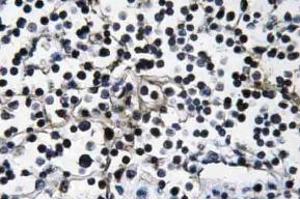 Immunohistochemistry (IHC) analyzes of PI 3-kinase p110alpha antibody in paraffin-embedded human lymph node tissue. (PIK3CA anticorps)
