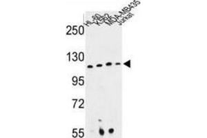 Western Blotting (WB) image for anti-Retinitis Pigmentosa GTPase Regulator Interacting Protein 1 (RPGRIP1) antibody (ABIN3003942) (RPGRIP1 anticorps)