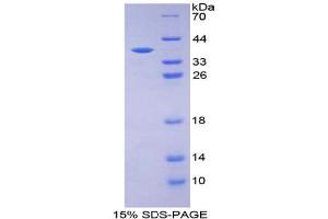 SDS-PAGE analysis of Human Glucose Transporter 14 Protein. (SLC2A14 Protéine)