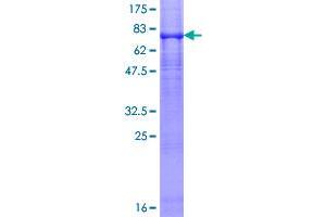 Image no. 1 for Purinergic Receptor P2X, Ligand-Gated Ion Channel, 5 (P2RX5) (AA 1-422) protein (GST tag) (ABIN1313812)