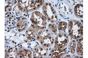 Immunohistochemical staining of paraffin-embedded liver tissue using anti-HDAC10mouse monoclonal antibody. (HDAC10 anticorps)