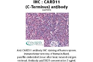 Image no. 1 for anti-Caspase Recruitment Domain Family, Member 11 (CARD11) (C-Term) antibody (ABIN1732635) (CARD11 anticorps  (C-Term))
